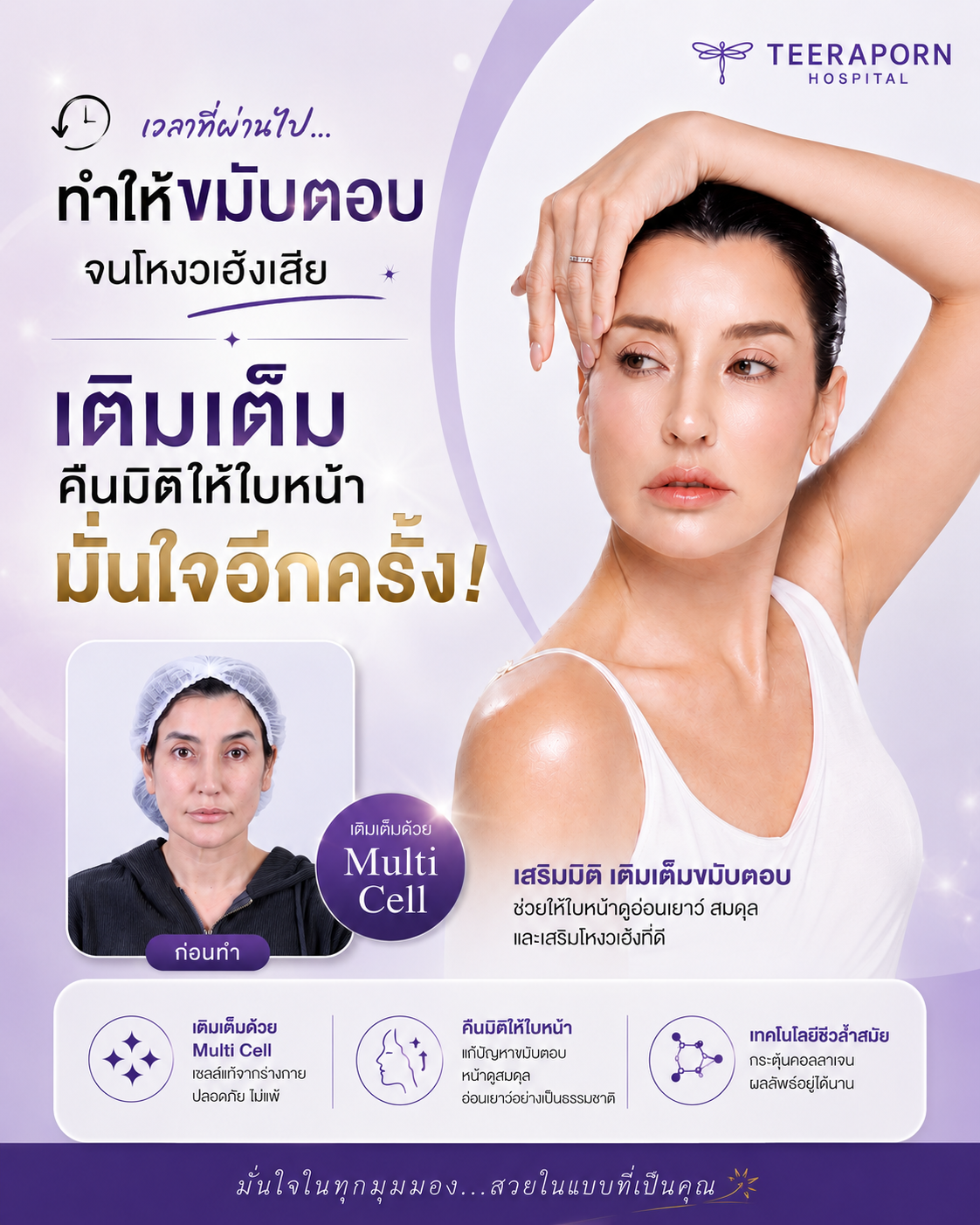 Multi Cell เติมเต็มขมับตอบและคืนมิติใบหน้า ช่วยให้ใบหน้าดูสมดุลและอ่อนเยาว์ โรงพยาบาลธีรพร