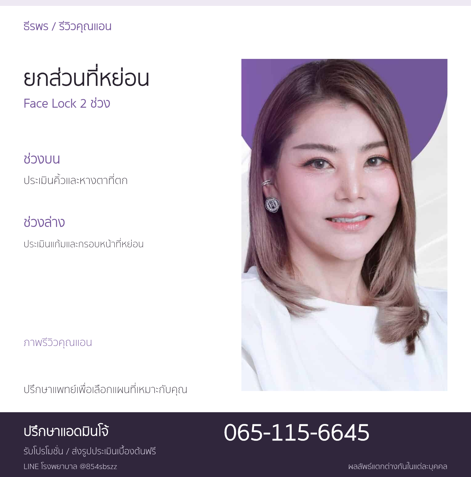 ภาพรีวิวคุณแอนประกอบข้อมูลดึงหน้า 2 ช่วง Face Lock ช่วงบนและช่วงล่างที่ธีรพร