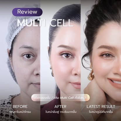 รีวิว Multi Cell ก่อน หลัง และผลลัพธ์ล่าสุดจาก Facebook เพจธีรพร